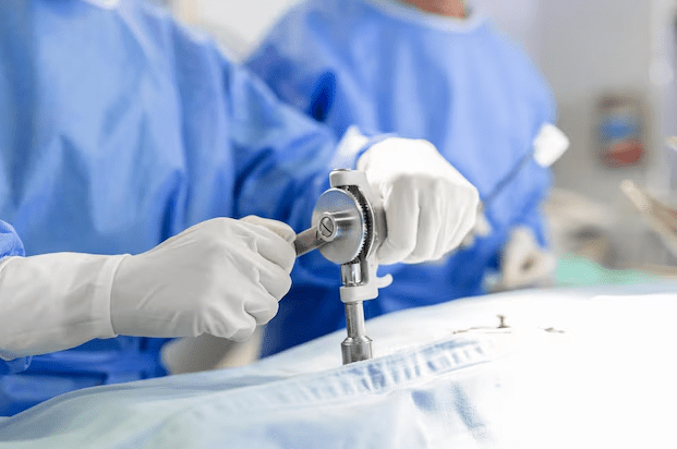 laparoscopic surgery in noida